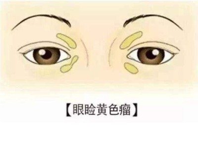 ҪԭЩ